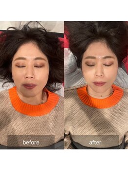 プライミー(PRIMY)/即効性◎顔幅マイナス