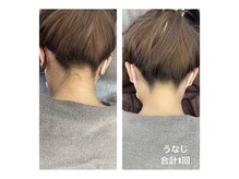 ディライト 名古屋駅店(Delight)/うなじ背中脱毛