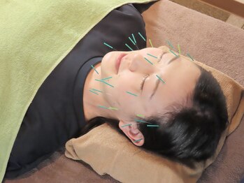 くるみ堂 祖師谷大蔵院/美容鍼