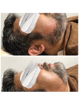 ハレノヒ(HaLeNoHi)/【ブラジリアンワックス】