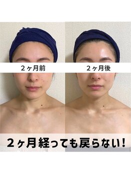お顔の研究所/ビフォーアフター写真♪