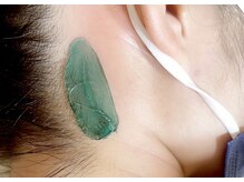 タイディ(TIDY)/うなじのワックス脱毛