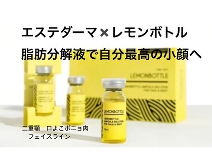 リノ(Lino)の写真