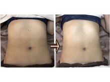 アルページュ(Arpege)/メリハリ美女お腹デザイン♪