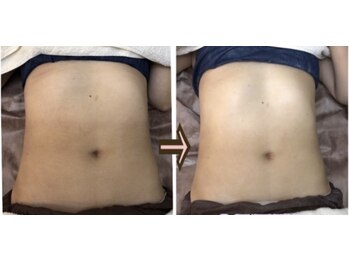 アルページュ(Arpege)/メリハリ美女お腹デザイン♪