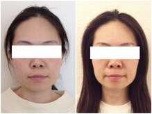 美容整体 ウェリナ 蟹江院/小顔矯正/骨盤矯正/美脚サロン