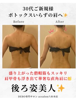 エーシーサロン 六本木店(acsalon)/脱!背中おばさん化で華奢見え♪