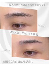 リノア(Linoa)/メンズ眉毛ビフォーアフター