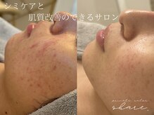 シェア(share.)