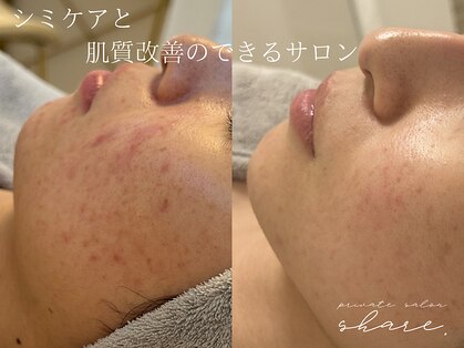 シェア(share.)の写真
