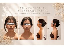 ヴィボーテ 東銀座店(Vie beaute)の雰囲気（【1回の結果】モデルさんや芸能人も密かに通う実力派サロンです）