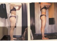 パーフェクトボディプレミアム 名古屋栄店(PERFECT BODY PREMIUM)/お客様　ビフォーアフター（33）