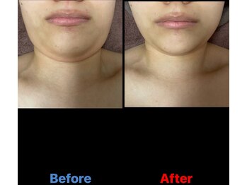 ガネェーシャ(Ganesha)/二重顎が別人並みに大変身♪