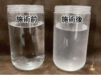 ルース(LUZ)/毛穴に詰まった汚れが見れます!