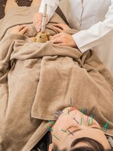 熊本鍼灸小雀斎/へそ灸