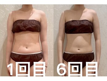 ビュール 銀座(BeauL)/ブライダルエステ