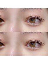 アンフルール エクラ 表参道店(Une fleur eclat)/【ラッシュリフト上下】