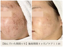 ビューティーホリック 蘇我店(BEAUTY HOLIC)の雰囲気（多くの方が４ヶ月で劇的変化をご体感して下さってます）