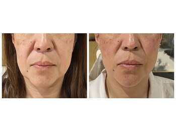 ねこのひげ/お客様の変化