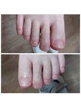 爪切り屋 足楽/