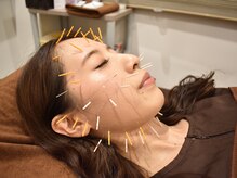 市川くじら鍼灸院/美容鍼フェイシャル