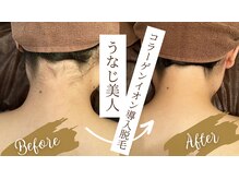 チャンティック(Cantik)/うなじケア