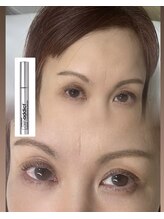 カマルスパラトゥ(KAMAL spa RATU)/育てたまつ毛×まつ毛パーマ