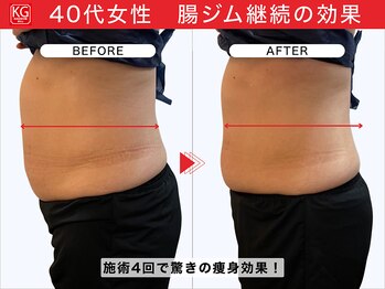 那賀洋子式 顔ジム 大分戸次店/腸ジム4回継続の効果