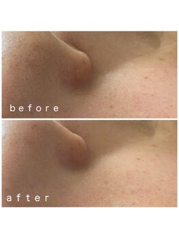 メナードフェイシャルサロン 岐阜茜部/美白/うるおい/透明感/毛穴