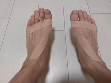 爪切り屋 足楽/テーピング