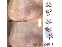 ジューンブライド(June Bride 61)/毛穴ケア