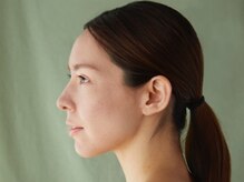 アニュ(a nu)/お客様任せにしない脱毛サロン