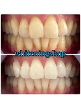 ホワイトニングショップ 山形店(Whiteningshop)/仕事帰りにホワイトニング