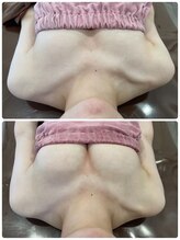 ロココ 豊田店(Rococo)/離れ乳を中央へ定着♪