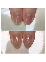 リヒネイル(Rihi.nail)/自爪育成