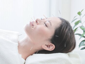 アーチ(Arch)の写真/【女性専用鍼灸院】大阪希少！「鍼灸×寝ながらよもぎ蒸し」で内外同時にアプローチ★頭皮鍼/美容鍼も施術