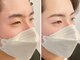 モアビューティ 光町店(MORE BEAUTY)の写真/【お顔の印象が一気に華やかに♪】アイブロウWAX脱毛導入◆左右の骨格バランスを見て整える美眉ケア★