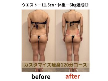 トータルビューティサロン スローティ ラテ 名古屋店/しっかりと効果を出します。