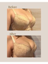 リネア(Linea)/【Before→After】30代後半