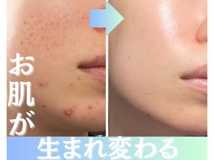 パールホワイトニングサロン 茅ヶ崎店の写真