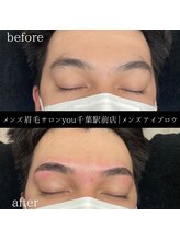 ユー 千葉駅前店(you)/ビフォ－アフター写真