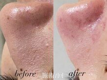 リスポアラボ(LIS PORE.LAB)/