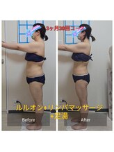 ヨサパーク マグリング(YOSA PARK Magring)/ビフォー&アフター