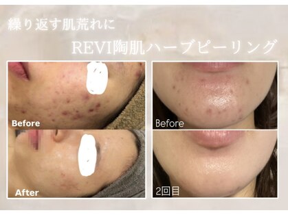 ルミナ(Lumina)の写真