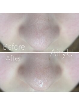 アイリーユー(Airy U)/イオン導出+毛穴吸引のW洗浄