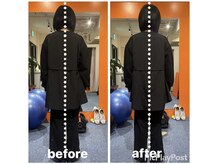 カワル整体 上通り院/【ひどい肩こりで痛みが走る】