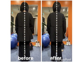 カワル整体 上通り院/【ひどい肩こりで痛みが走る】