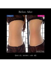 レクリエイター(Re:QREATOR)/セルフエステ(before after)