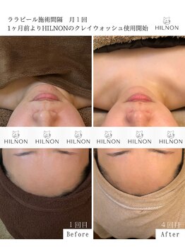 ルポザメンテナンス 長岡店(RUPO THE MAINTENANCE)/