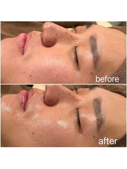 アムールドゥ 麻布十番(Amour deux)/サーマトリックス